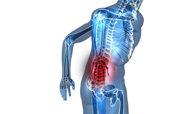 Back Pain Diagram